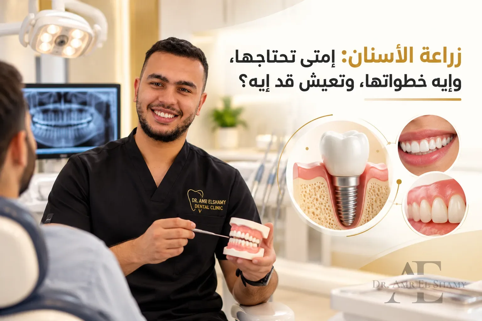 خلعت سنة؟ ليه متسيبش مكانها فاضي